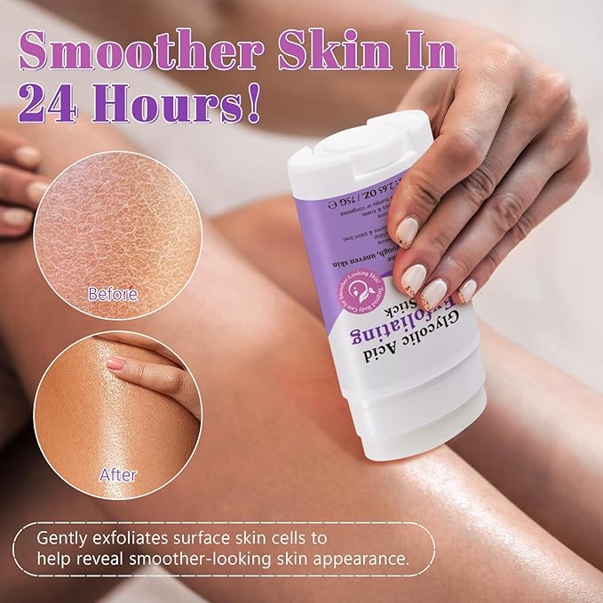 Glycolic Acid Exfoliating Body Stick with 7% AHA & 0.5% BHA – Solid Body Exfoliator for Rough & Bumpy Skin, KP, Dark Spots – No Mess, No Rinse – With Shea Butter