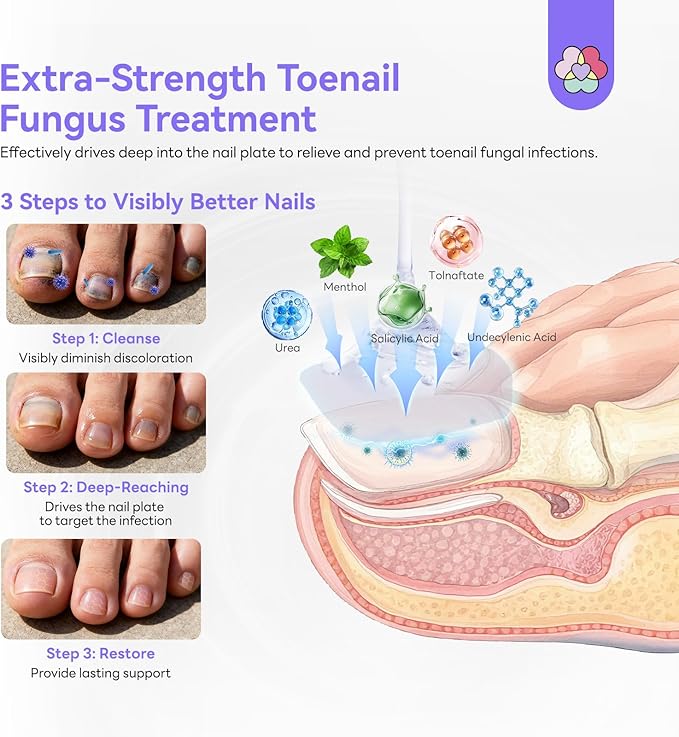 SAVILAND Toenail Fungus Treatment Extra Strength FSA-HSA: 2X Extreme Nail Repair for Discolored and Damaged Nails Toenail Softener Yellow Toenail Foot Toe Thick Nail Fungus Treatments Solution 2 fl oz