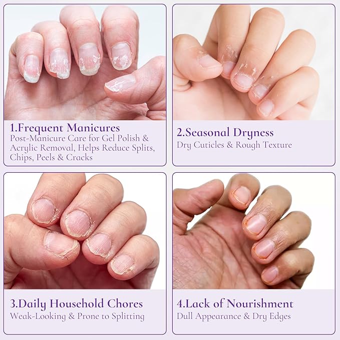Nail & Cuticle Cream with Keratin, Biotin & Ceramides – Non-Greasy Deep Hydration, Strengthens Nails & Softens Cuticles, 15ml(Pack of 1)