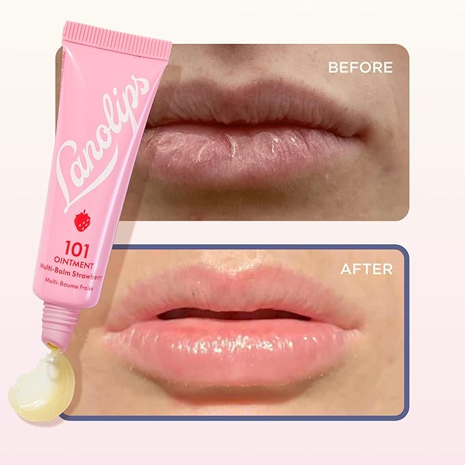 Lanolin 101 Multipurpose Ointment - Lanolin Lip Balm & Healing Ointment for Skin Barrier Repair - Moisturizer for Dry Lips, Cuticles & Elbows - No Petroleum Formula - Strawberry (0.35 oz)