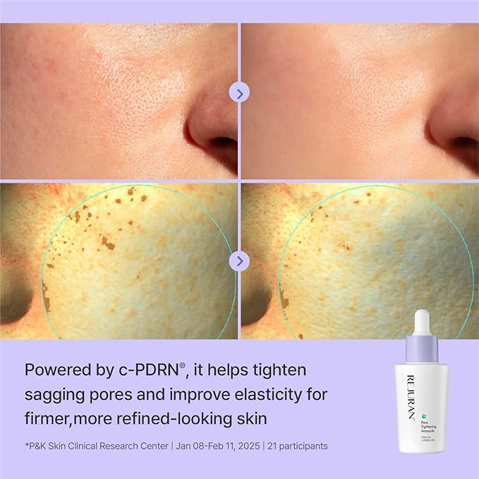 REJURAN® Pore Tightening Ampoule – PDRx 5% & c-PDRN 0.5% Facial Serum with AHA/PHA/BHA/LHA & Witch Hazel – Helps Refine the Look of Pores and Improve Skin Texture – Dropper Type Korean Skincare