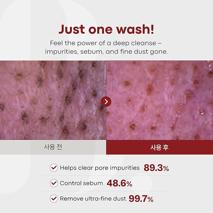 PDRN Deep Cleanser - Korean Deep Cleansing Foam for Pore Care with 1% Salmon-Derived Nano-PDRN, Kaolin, Zinc PCA | Stretchy Whipped Foam | 4.23 oz. / 120g