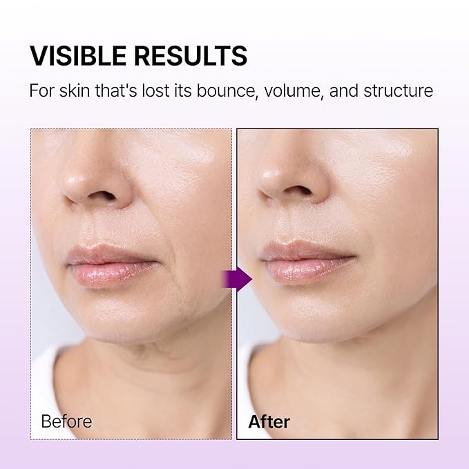 Dr.Melaxin Calcium Bonding Serum with REBORNIC 10,000ppm, Firming & Volumizing Serum for Sagging Skin, Calcium Complex & Collagen for Elasticity & Skin Density, 1.69 fl.oz