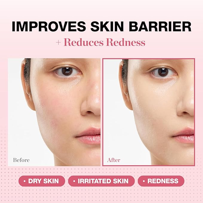 PHYSIOGEL Redness Reducing Cream – Ceramide Moisturizer for Dry, Sensitive & Redness-Prone Skin, Repairs Skin Barrier, Dermatologist-Tested, Fragrance-Free, Korean Skincare, 1.69 fl oz