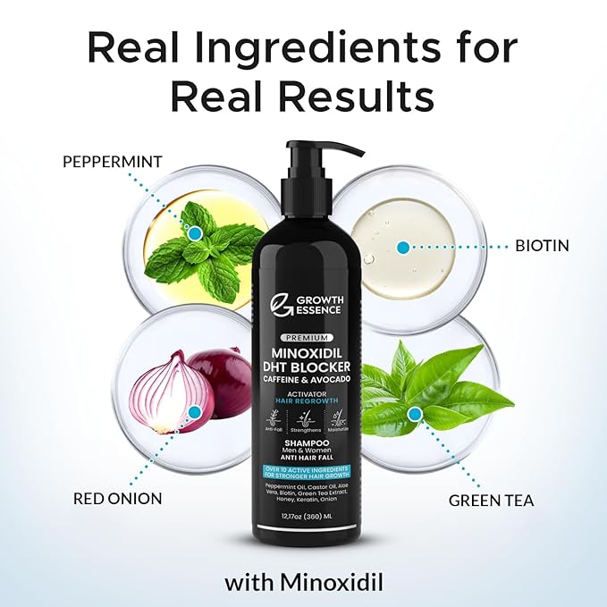 Minoxidil & Biotin Shampoo for Hair Growth - Enriched with Caffeine, Castor Oil & Onion - DHT Blocker for Thicker, Healthier Hair - Strengthening Formula for Men & Women