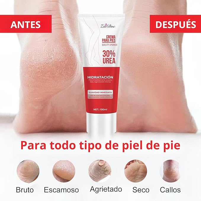 2 Pack Urea Cream 30 Percent for Feet 3.38 oz, Foot Cream and Hand Cream Maximum Strength with Hyaluronic Acid, Aloe Vera for Deep Moisturizes, Callus Remover