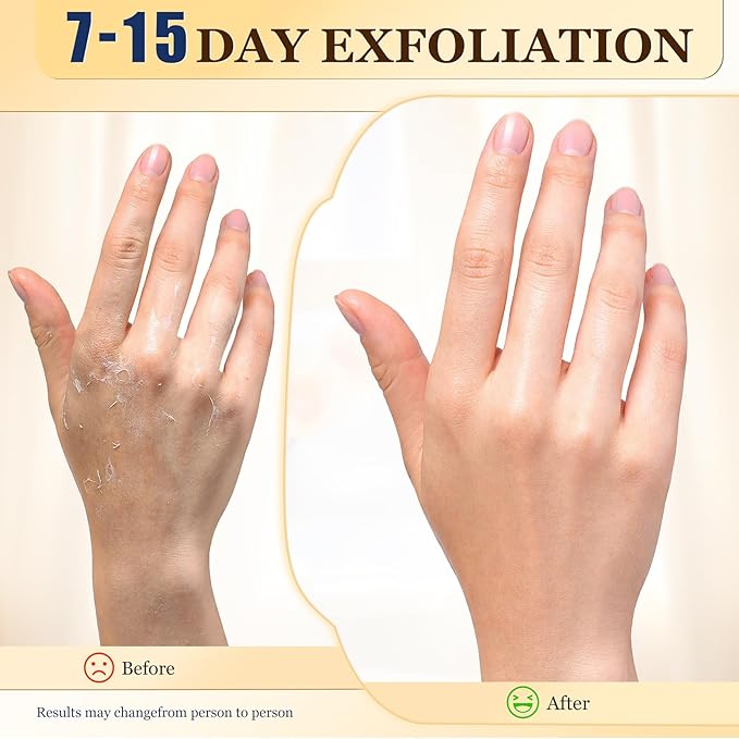 Z:SEA Repairing Hand Masks, Moisturizing Gloves for Dry Hands, Healing & Softening Rough Skin, Remove Wrinkles & Hangnails with Shea Butter, Niacinamide, Vitamin E & Glycerol, 5 Pack