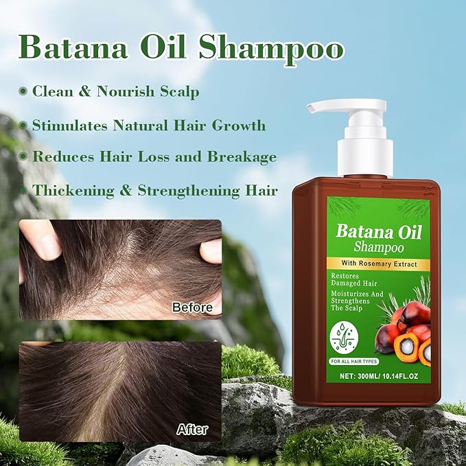 -Promote Hair Growth,Rosemary Shampoo,Nourishes Scalp, Reduces Breakage & Adds Shine,Reduces Hair Loss (Batana Shampoo-(10.1 fl oz))