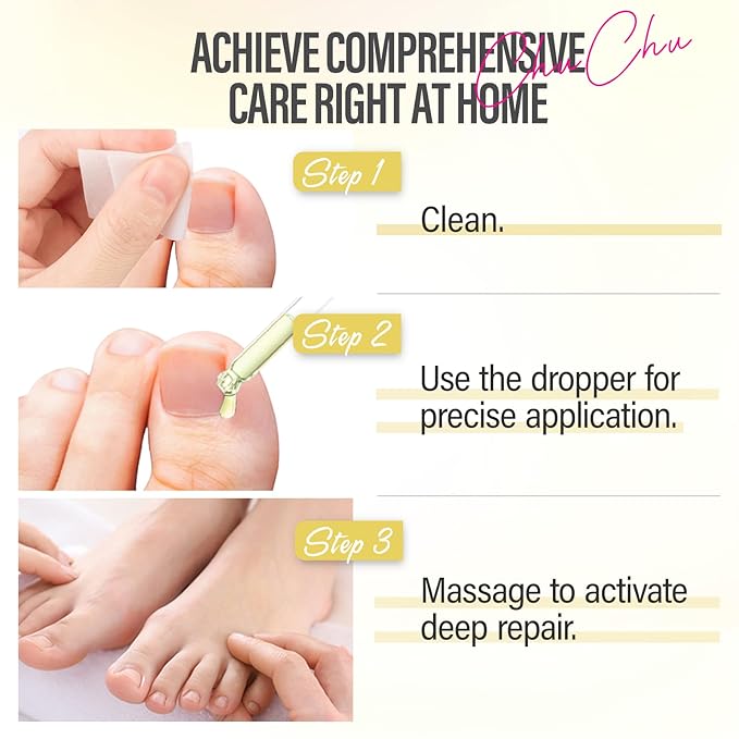 CHUCHU Vegan Cuticle Oil for Nails: Tea Tree Jojoba Nail Cuticle Oil with Vitamin B & E for Moisturizes Cuticle and Nail's Skin - Prevents Hangnails and Chapped 15ML