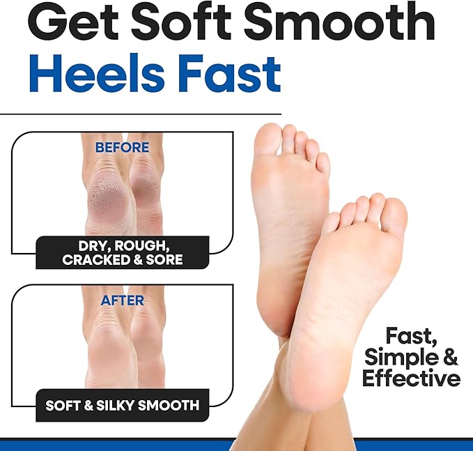Moisturizing Socks for Men & Women | Aloe Vera Cracked Heel Treatment | Foot Callus Remover | Aloe Socks for Cracked Heels & Dry Feet | Lotion Infused Gel Heel Sleeves (Large - 2 Pairs)