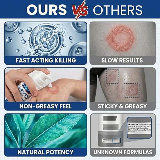 Antifungal Ringworm Treatment Cream, - Miconazole Nitrate 2% Antifungal Cream for Humans - For Fast Itch Relief, Jock Itch & Athlete's Foot - Cream with Ceramides & Tea Tree Oil, Non-Greasy, 3.53oz