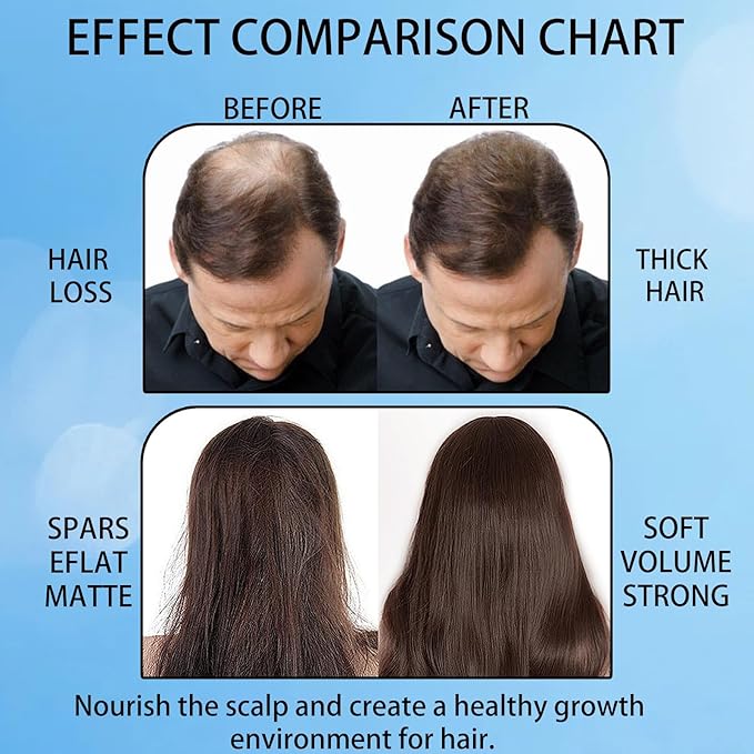 Hair Growth Roll On, Rosemary Hair Growth Serum, Advanced Hair Growth Roll-On Serum, Thicker & Stronger Hair, Nourishes Scalp & Roots for All Hair, Women and Men (3pcs)