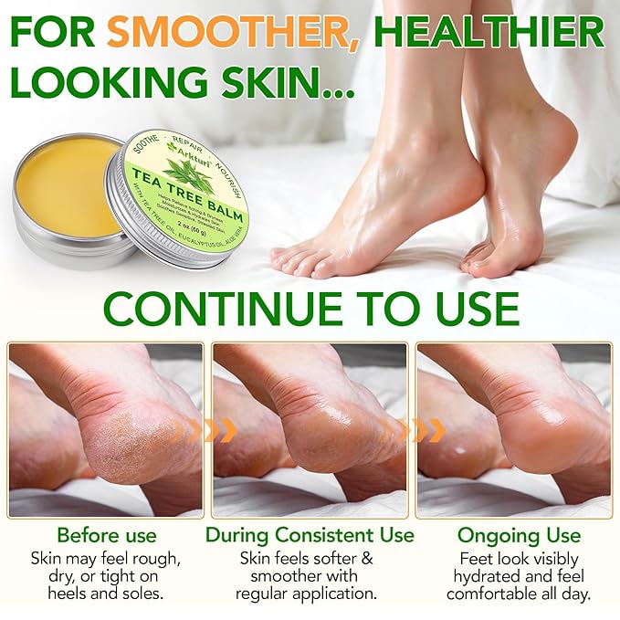 Tea Tree Oil Balm, Tea Tree Oil for Skin, Tea Tree Oil Balm for Dry Skin Relief - Irritated Skin, Cracked Heels - Organic & Safe for All Ages (1 Pack)