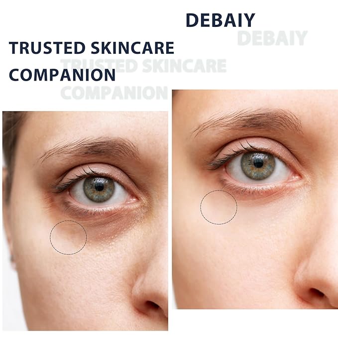 3% Caffeine Eye Cream for Dark Circles Puffiness & Bags Under Eyes Night Cream (3 Pack 15g Each)
