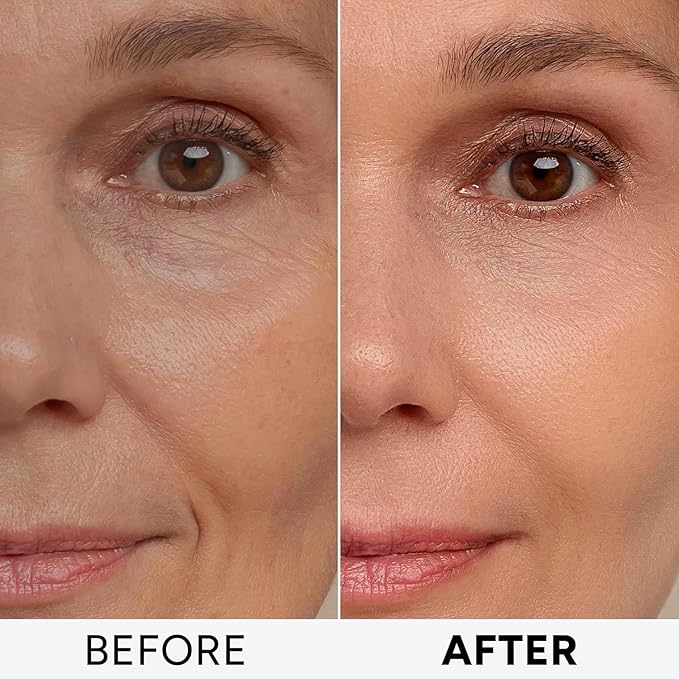Retinol Cream for Face with Collagen and Hyaluronic Acid - Anti Aging Wrinkle Cream for Women and Men - Day and Night Facial Moisturizer for Tightening and Skin Firming - Crema Hidratante Para la Cara