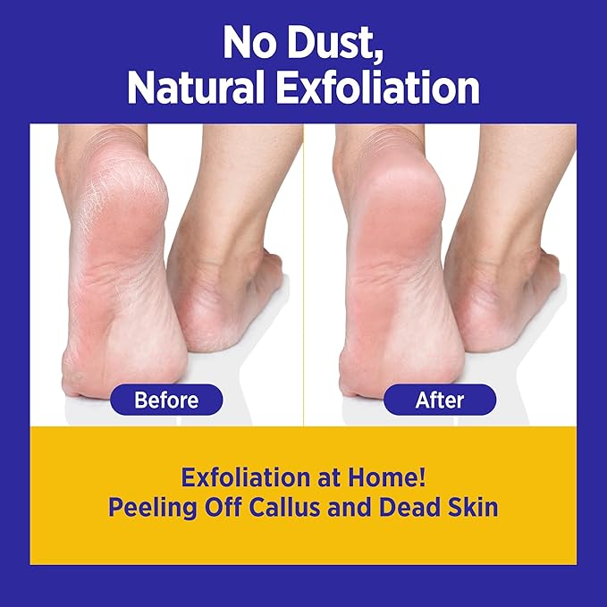 Clarifying Foot Peel Mask, Moisturizing, for Cracked Heels & Excessive Dead Skin, AHA, Soft Smooth Touch Feet, One Size for Men & Women, Self Home Care, 12 Packs