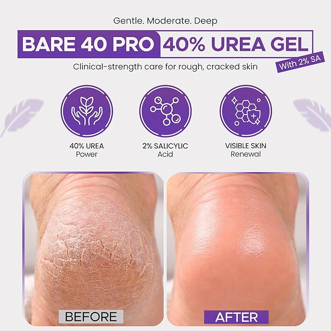 BARE 40 PRO 40% Urea Gel with 2% Salicylic Acid, Hyaluronic Acid, Tea Tree Oil & Aloe Vera – Exfoliating & Hydrating Foot and Body Gel for Dry, Rough Skin, 4oz Jar, Made in USA