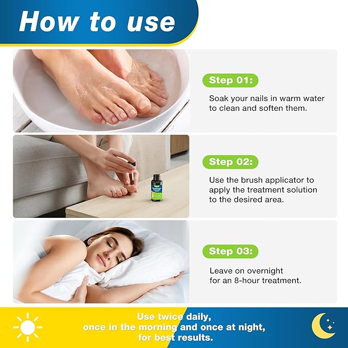 Toenail Fungus Treatment Extra Strength – Maximum OTC with 25% Undecylenic Acid – for Thick, Nail Strengthener and Growth, for Broken, Discolored Nail & Ingrown Toenail, 30ml