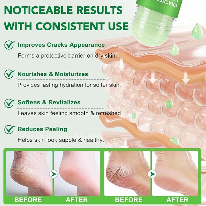 Cracked Heel Urea Stick,Aloe vera Scent,Foot Care Cream 60 Percent Stick,Maximum Strength Urea Cream for Feet,Moisturizer and Hydrates Dry Cracked Feet, Knees, Elbows, Hands