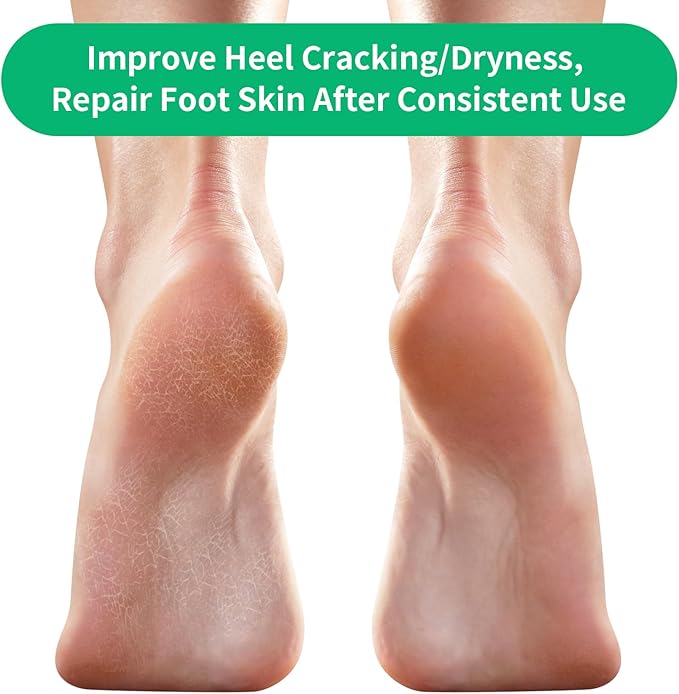 Cracked Heel Treatment Repair Socks - Ohtomber 5 Pairs Silicone Gel Foot Care Softener Toeless Pedicure Moisturizing Dry Feet Socks for Dry Cracked Heels