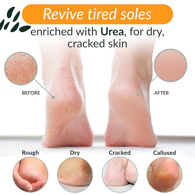 Tree To Tub Foot Cream for Dry Cracked Heels and Feet - Foot Lotion for Dry Cracked Feet, Non-Greasy Moisturizer Urea Cream w/Softening Shea Cocoa Butter, Citrus Foot Care for Women & Men