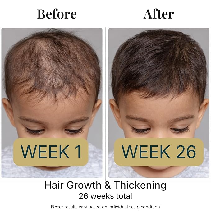 REVATOLOGY Kids & Baby Hair Growth Product High Potency Scalp & Hair Oil (Made in USA) 26 Cold-Pressed Botanicals for all Ages and Hair types Thin, Curly, Waivy for Hair Growth, Dry/Itchy Scalp