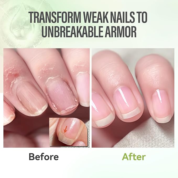 CHUCHU Vegan Cuticle Oil for Nails: Aloe Vera Jojoba Nail Cuticle Oil with Vitamin B & E for Moisturizes Cuticle and Nail's Skin - Prevents Hangnails and Chapped 15ML