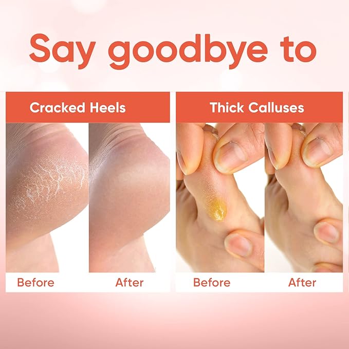 CÉLOR Foot Peeling Mask for Dry Cracked Feet | Foot Mask to Exfoliate Rough, Cracked, Dry Feet, Calluses for Soft Baby Feet Results | Made with Aloe Vera Extract for Women & Men (2 Pairs) | Peach