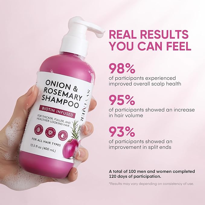 Svvimer Onion Rosemary and Biotin Shampoo - Hair Growth Shampoo for Hair Loss and Thinning - Thickening and Strengthening Formula for Men & Women Sulfate Free 13.5 Fl Oz (Pack of 1)