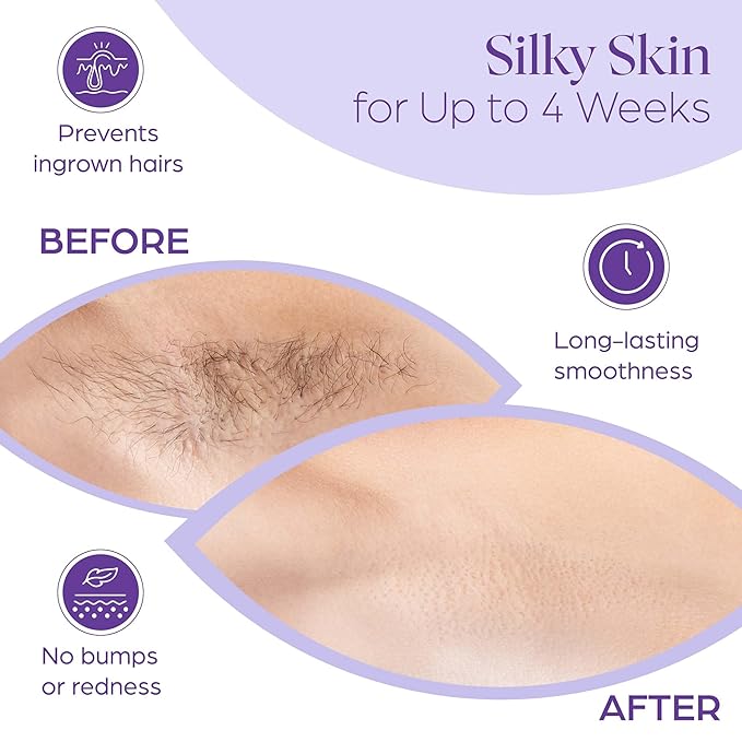 160 Wax Strips for Hair Removal – Extra-Large Non-Woven Strips for Legs, Arms, Back & Body – Works with All Soft Waxes – Salon & Home Use