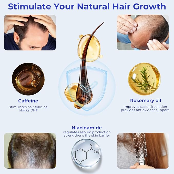 Rosemary Oil Hair Growth Serum Roll On – 3% Rosemary Oil, 2% Caffeine, 2% Niacinamide & DHT Blocking Complex, Non-Greasy Scalp Serum for Men & Women, Designed for Thinning, Fine & Weak Hair