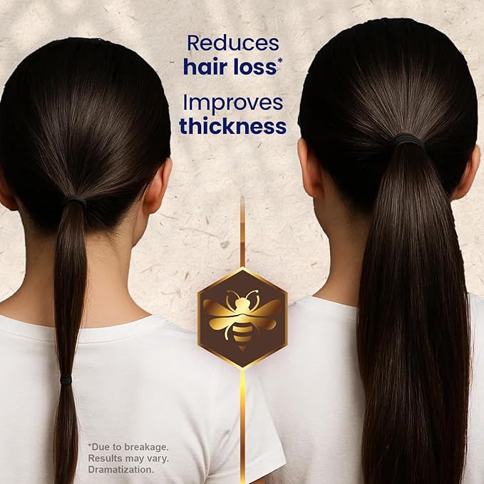 Tio Nacho Thickening Shampoo for Thinning Hair for Women & Men with Royal Jelly & Nettle Extract – Volumizing Hair Loss Shampoo for Fine Hair, Paraben Free, 14 fl oz