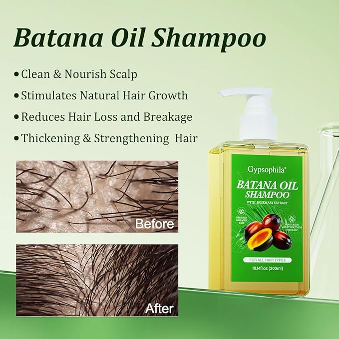 2 PACK Batana Oil Shampoo, Rosemary Shampoo,Nourishing & Rejuvenating for Softness & Volume, Suitable for Men & Women, Reduces Hair Loss (20.28.14 fl oz)