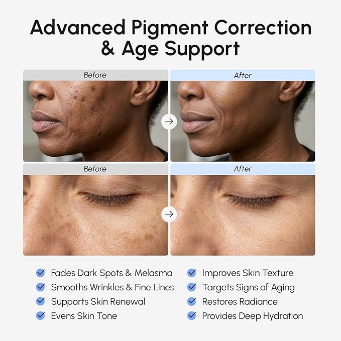 MAREE TXA Tranexamic Acid Serum Cream with Microspicules 100,000 PPM Complex - Alpha Arbutin Cream - Face Crema para Manchas Oscuras en la Cara
