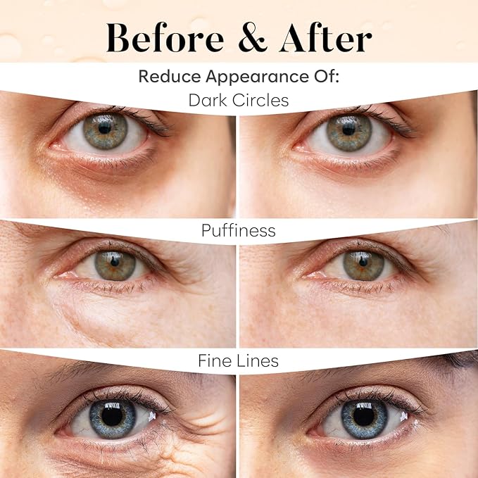 BLOOMORA Caffeine Under Eye Patches (30 Pairs), Under Eye Mask for Puffy Eyes, Appearance of Dark Circles, Cooling & Hydration, Self Care & Skincare Gifts for Women, Patch Yeux
