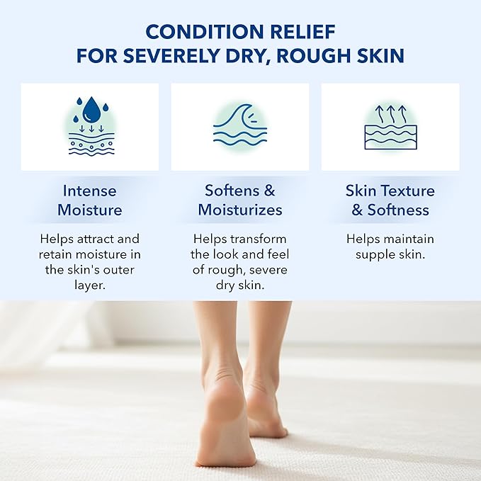 Urea 20% Cream with Vitamin E for Severe Dry, Rough and Scaly Skin, Intense Moisturizer and Gentle Exfoliator for Hands, Feet, Elbows and Knees Inc, 3 oz
