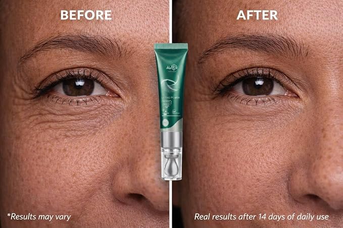 Lifting Power Eye Fluid – Eyelid Lifting Treatment for Hooded Eyes & Fine Lines – Multi-Peptide Eye Serum with Ceramide NG, Hyaluronic Acid & Palmitoyl Tripeptide-1 – 0.5 fl oz / 15 ml