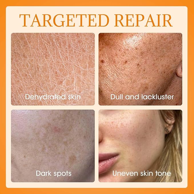MQ Vitamin C Cream Visibly Brightening Body Lotion | Vitamin C Moisturizer Care Body Cream, Revitalizes Dull-Looking Skin, Promotes A Glowing Complexion