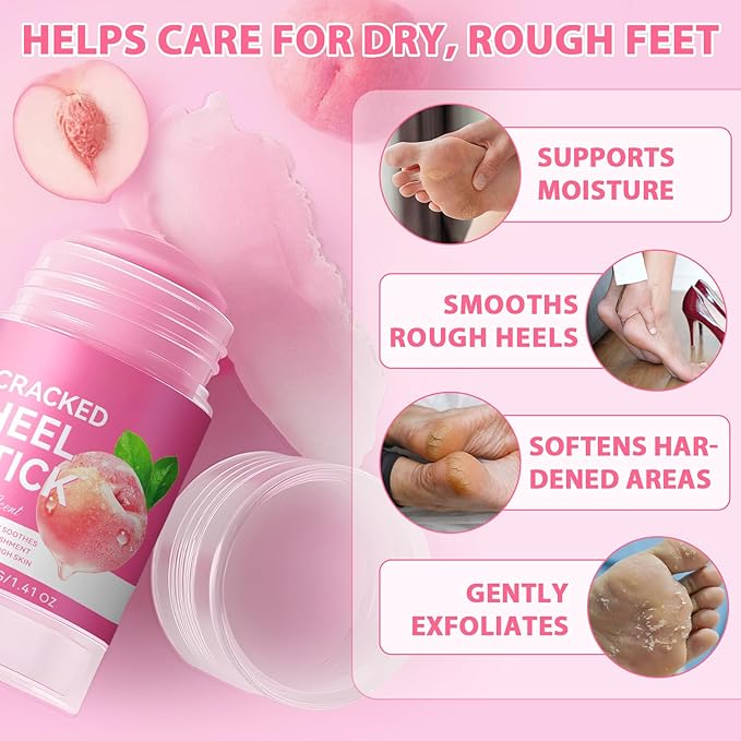 Cracked Heel Urea Stick,Peach Scent,Foot Care Cream 60 Percent Stick,Maximum Strength Urea Cream for Feet,Moisturizer and Hydrates Dry Cracked Feet, Knees, Elbows, Hands