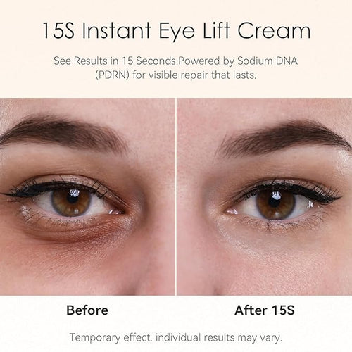 15-Second Instant Eye Lift Cream with Sodium DNA & 0.1% Retinal | Rapid Tightening for Eye Bags & Fine Lines | Dual-Action Firming + Long-Term Repair (0.7 Fl Oz (Pack of 1))