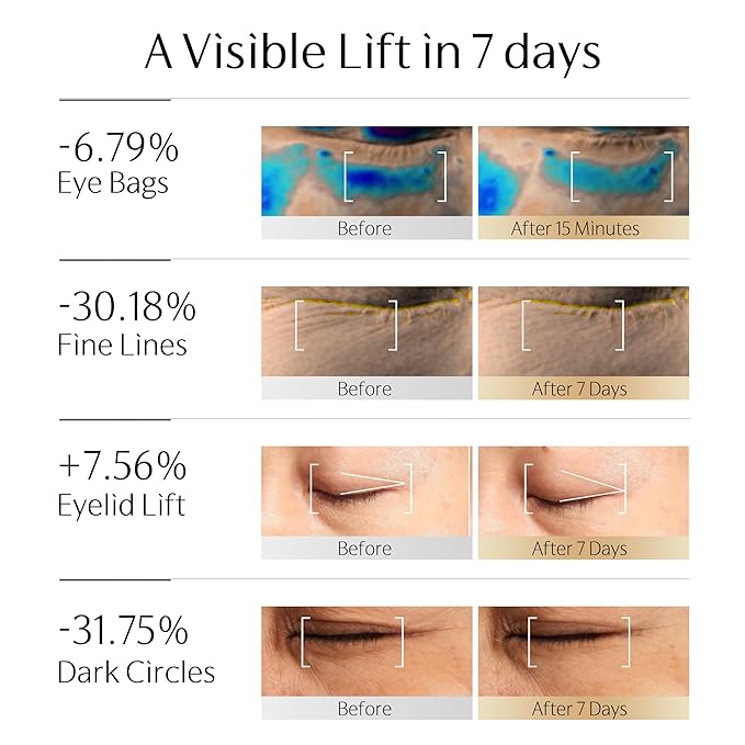 EMS Eye Cream for Puffiness Bag Under Eye | Exosome & PDRN Vibrating Eye Tightener Cream for Dark Circle | NAD+, Caffeine, Peptide, Collagen | for Firming, Reducing Wrinkle(0.88 oz/25g)