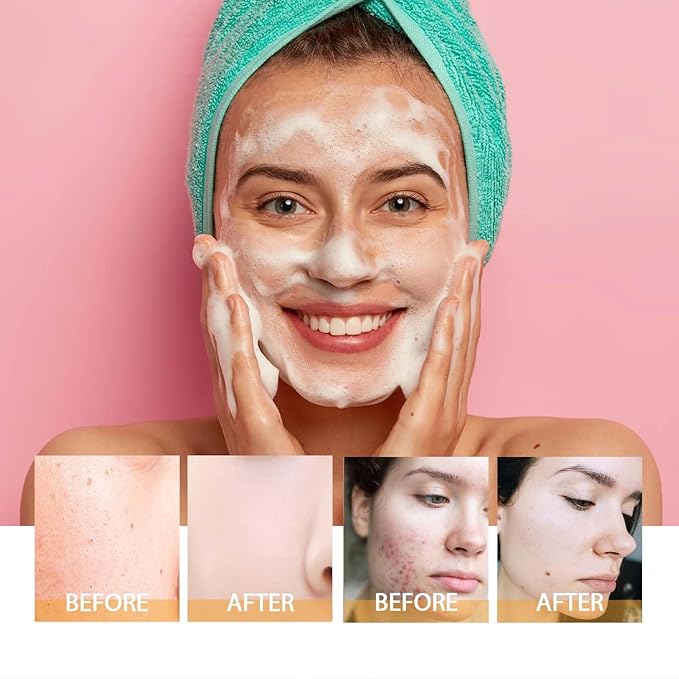HOYGI Turmeric Face Wash with Brush, Turmeric Foaming Facial Cleanser for All Skin, 3.38 Fl Oz/pcs