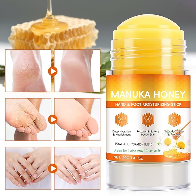 2 Pack Manuka Honey Cracked Heel Treatment Balm Stick, Dry & Cracked Foot Repair for Intensively & Deeply Moisturizing & Hydrating, Soothing, with Shea Butter, Chamomile|1.41 Oz/40 G
