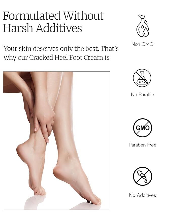 AEOLIS 10% Urea Foot Cream for Cracked Heels (2.03 fl oz), Beeswax, Shea Butter, Aloe Vera & Vitamin E Deep Moisturizing Care for Rough Feet Dry Heels Treatment & Softening