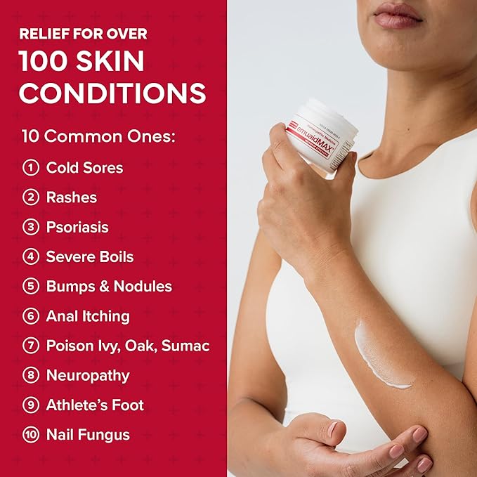 emuaid EMUAIDMAX Eczema Ointment, Maximum Strength Soothing Relief for Eczema, Psoriasis, Athlete’s Foot, Jock Itch, Rashes, Itchy, Dry, Irritated Skin and Minor Skin Irritations, 16oz (Pack of 2)
