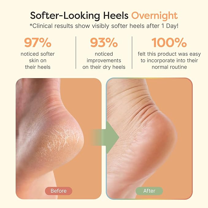 ZenToes Moisturizing Socks for Cracked Heel Treatment, Vitamin E, Olive Oil and Jojoba Oil Infused Heel Socks, Spa Gifts for Women, Mothers Day Gifts (Lemons, Regular)