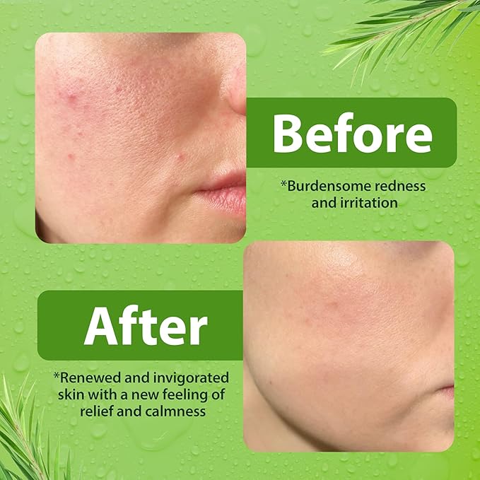 Derma-Nu Gentle Face Wash for Men & Women Hydrating Facial Cleanser for Eczema, Psoriasis & Sensitive Skin Fights Redness, Oil & Breakouts pH-Balanced & Perfect for Oily, Blemish-Prone Skin 8oz