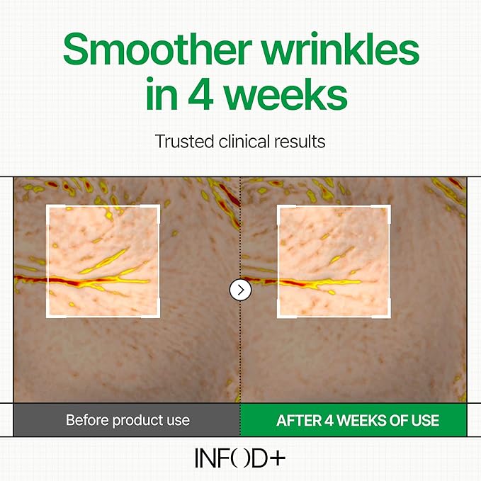 INFODPLUS Sensitive Skin Moisturizer Face Cream with Ceramide and Panthenol, Barrier Repair Support Hydrating Soothing Cream, Lightweight Calming Facial Moisturizer, Korean Skincare 1.69 fl oz, 50ml