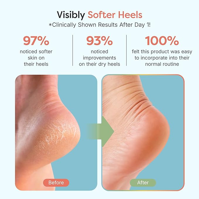 ZenToes Moisturizing Socks for Cracked Heel Treatment, Vitamin E, Olive Oil and Jojoba Oil Infused Heel Socks, Spa Gifts for Women, Mothers Day Gifts (Fuzzy Blue, Regular)