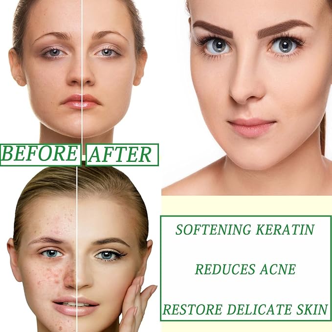 10 Pack Sheet Face Mask Set,Moisturizing Long Lasting Facial Sheet Masks Combo,Hydrating Face Masks for All Skin Types